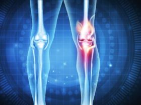 WHAT DOES A RHEUMATOLOGIST TREAT