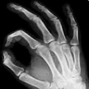 Can you identify the disease?