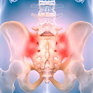 Axial Spondyloarthritis in India: A Tip of the Iceberg